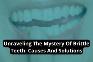 Close-up of teeth with guide on brittle teeth causes and solutions at Great Oaks Dentistry in New Braunfels