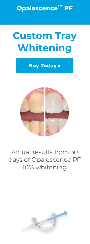 Opalescence teeth whitening treatment results showcased at Great Oaks Dentistry in New Braunfels