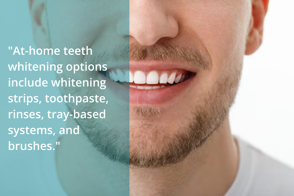 At-home teeth whitening options include toothbrushes and brush-based systems.