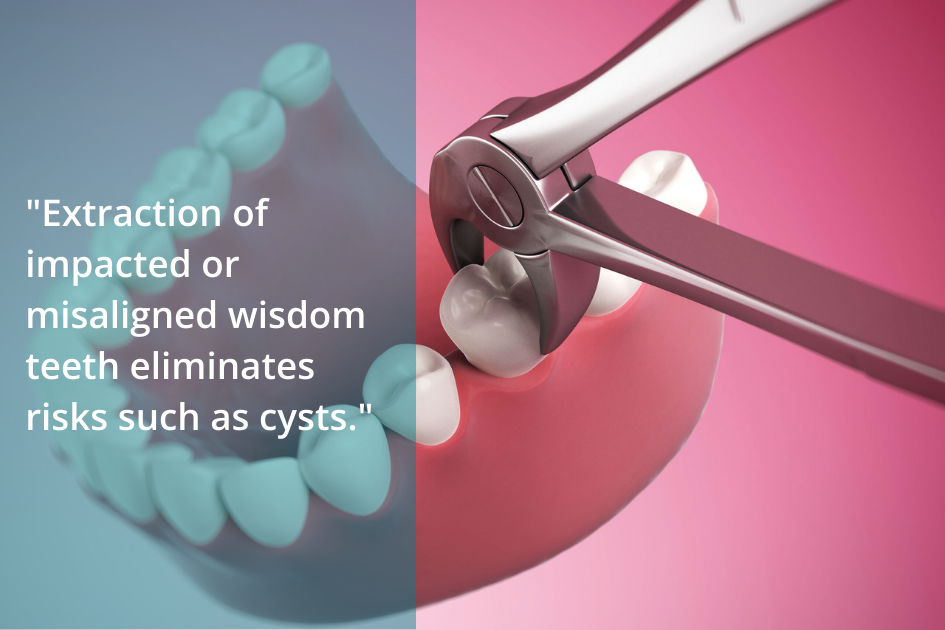 Extraction of wisdom teeth removes the risk.