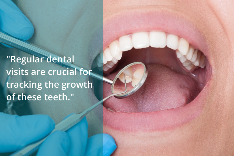 Regular dental visits are crucial for tracking the growth of wisdom teeth.