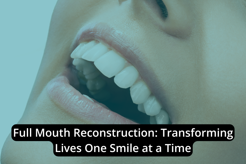 Close-up view of a person’s mouth showcasing pristine white teeth with the text, "Full Mouth Reconstruction: Transforming Lives One Smile at a Time," superimposed on the image.