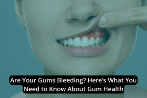 Close-up of a person pulling their lip to expose their gums. The text reads: "Are Your Gums Bleeding? Discover What You Need to Know About Gum Health.