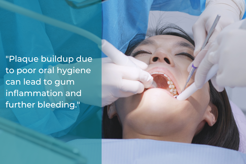 A dentist examines a patient's teeth while another holds a suction tool, carefully addressing issues related to plaque buildup and bleeding gums. A text overlay dives into the importance of maintaining optimal gum health.